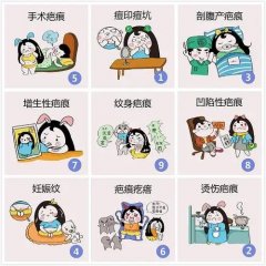 Ƥ���̺�ɫ�س�����ô����