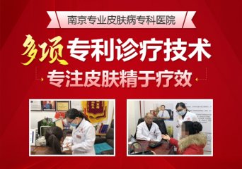 常州市看牛皮癣哪个医院好